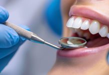 Why Regular Tooth Scaling and Polishing Is Essential for Oral Health Teeth Whitening