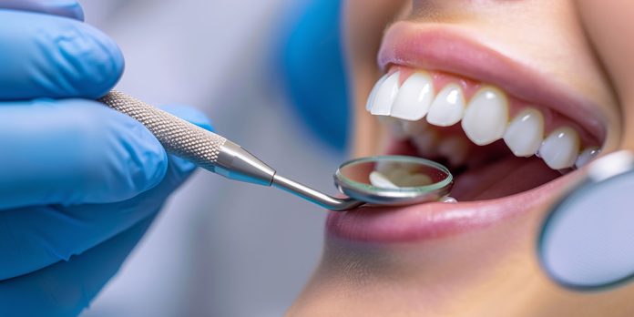Teeth Whitening